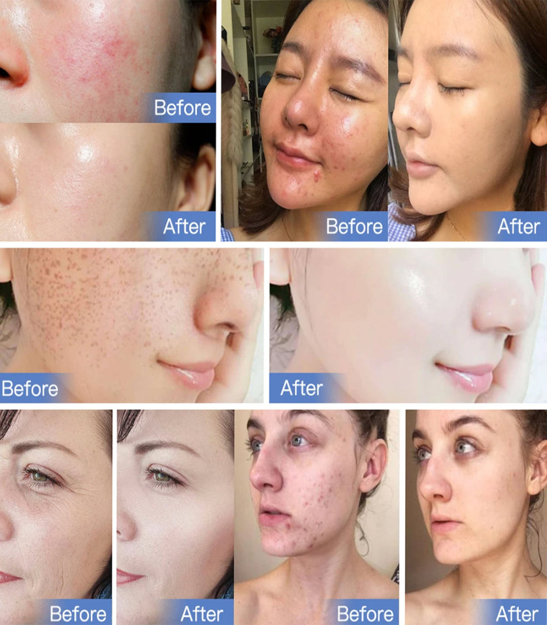 7 Färger LED Ljusterapi Maskin - Den Ultimata Lösningen För Dina Hudvårdsbehov
